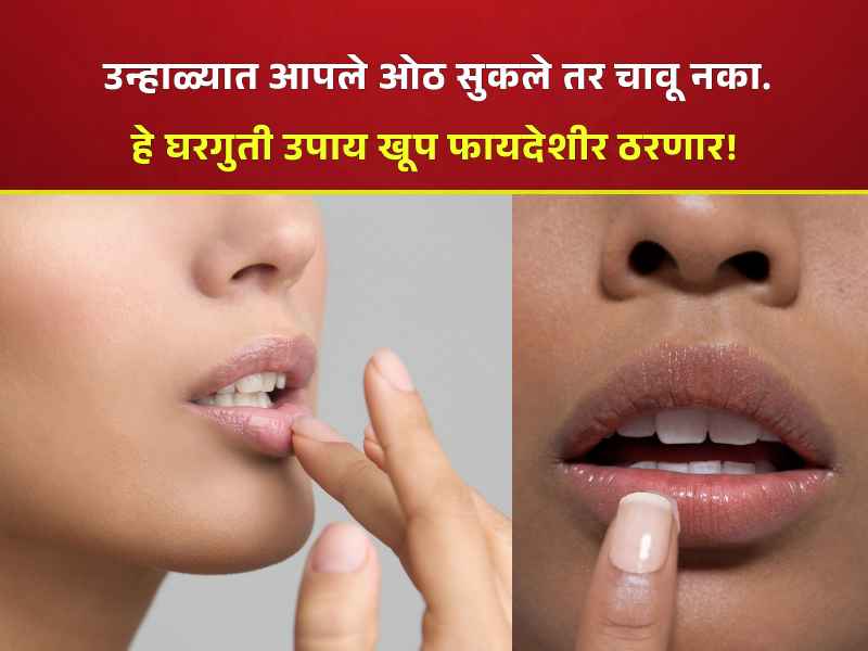 Home Remedies For Dry Lips